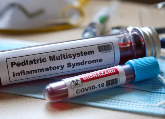 ivig-glucocorticoid-combination-therapy-reduces-need-for-adjunctive-immunotherapy-in-pediatric-mis-c