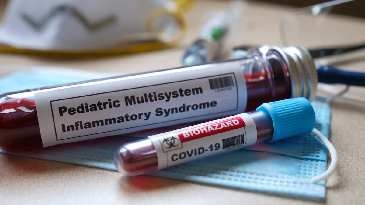 IVIG-Glucocorticoid Combination Therapy Reduces Need for Adjunctive Immunotherapy in Pediatric MIS-C
