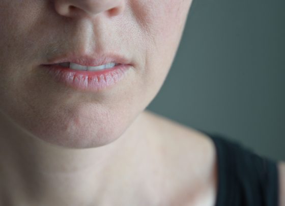 help-patients-prevent-and-treat-dry-mouth