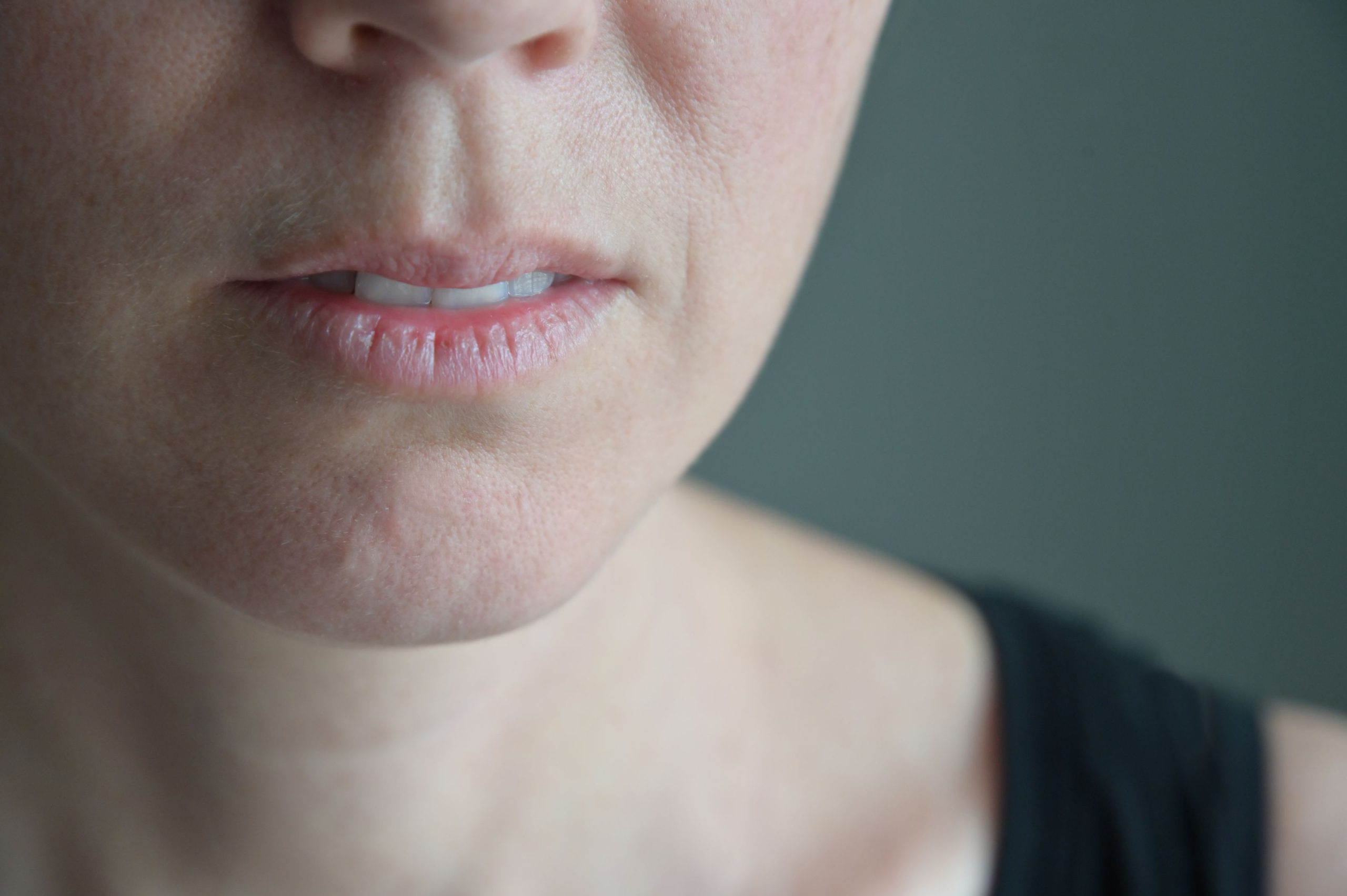 Help Patients Prevent and Treat Dry Mouth