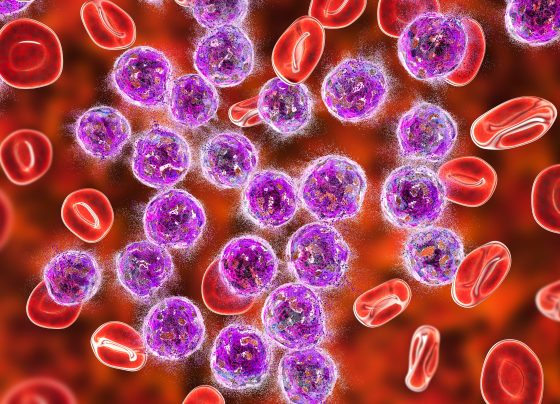 asco-2025:-age-related-differences-in-relapsed/refractory-all-treatment-outcomes