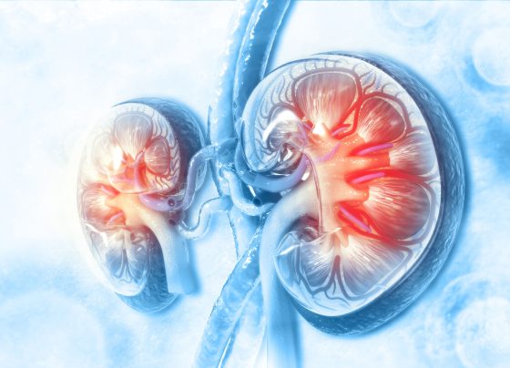 fda-issues-complete-response-letter-to-manufacturer-of-olc,-treatment-for-ckd-related-hyperphosphatemia