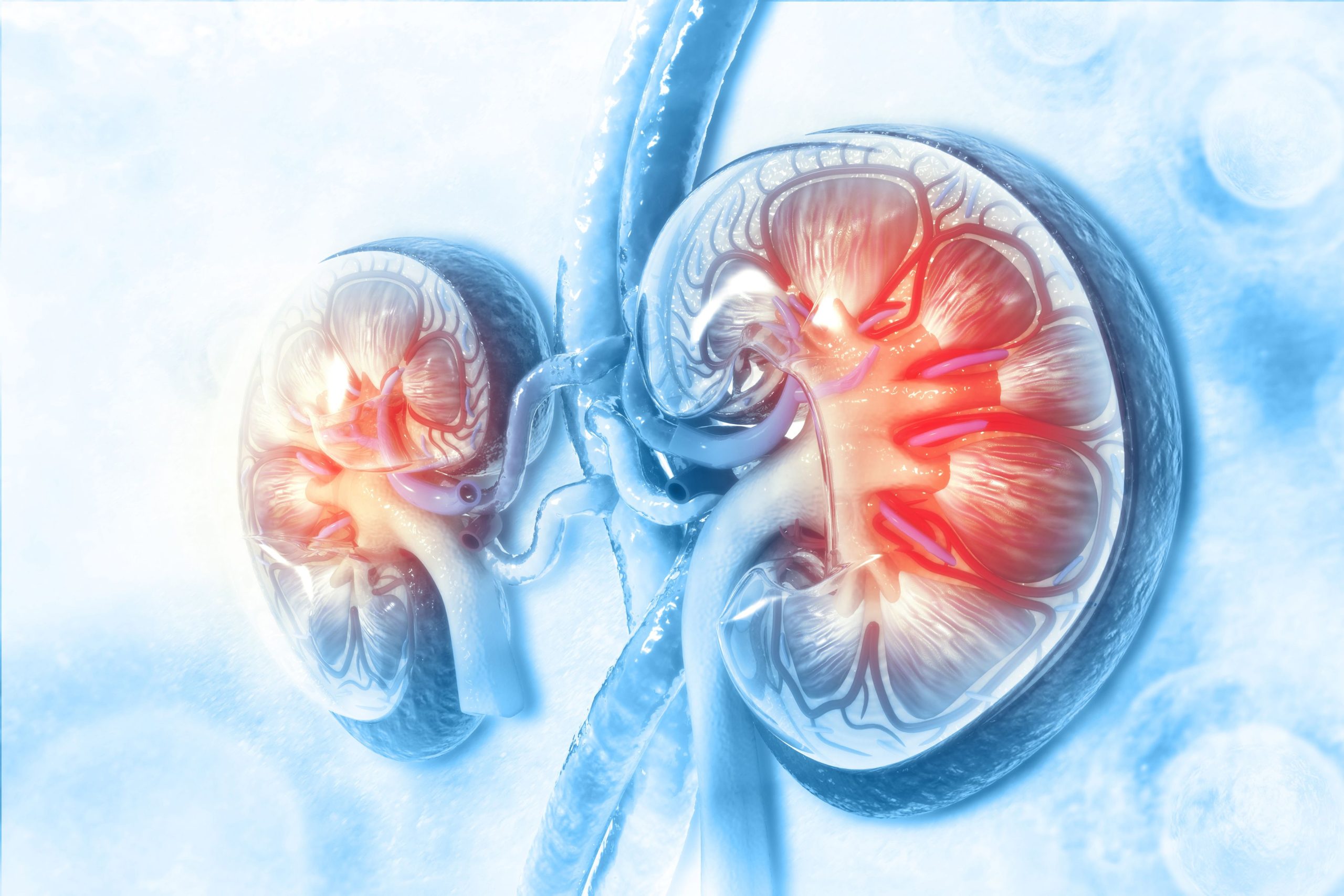 FDA Issues Complete Response Letter to Manufacturer of OLC, Treatment for CKD-Related Hyperphosphatemia
