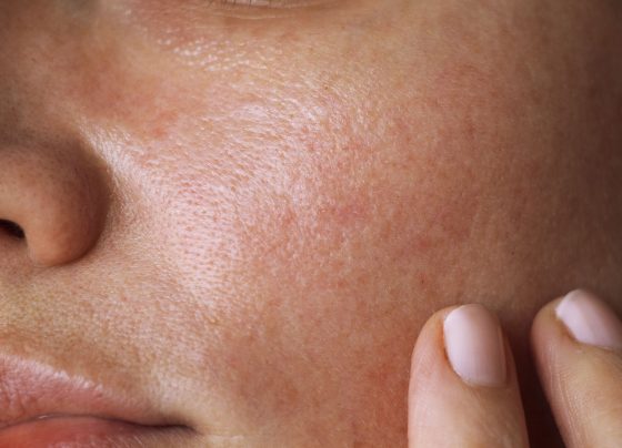 study-examines-how-vitamin-c-shapes-skin-health-through-tet-mediated-demethylation