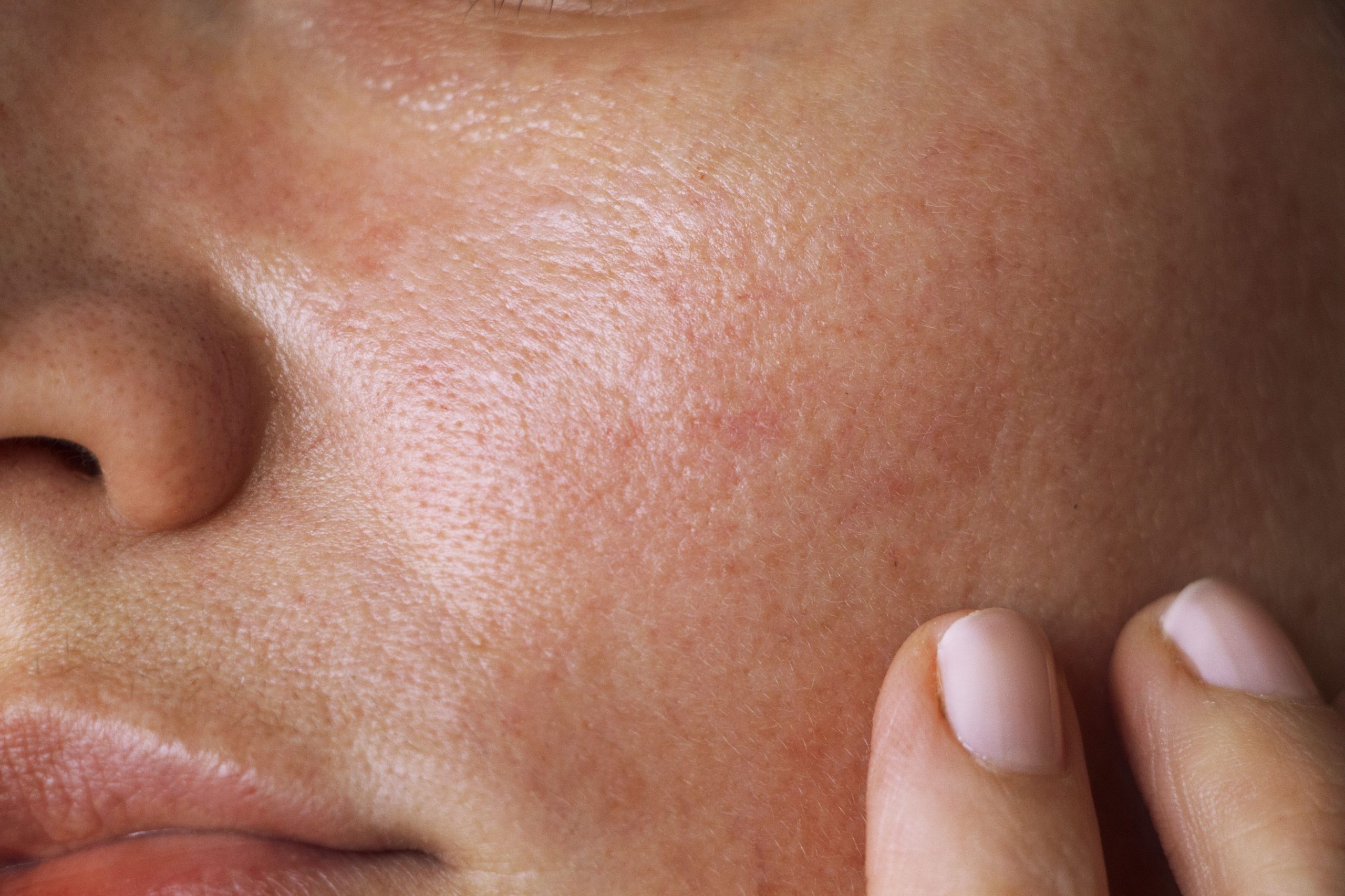 Study Examines How Vitamin C Shapes Skin Health Through TET-Mediated Demethylation