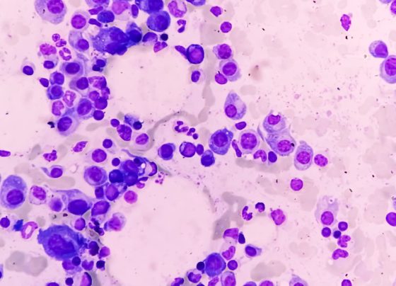 fda-approves-linvoseltamab-gcpt-for-treatment-of-relapsed-or-refractory-multiple-myeloma