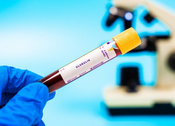 fda-approves-immunoglobulin-formulation-with-low-iga-content-for-primary-immunodeficiency