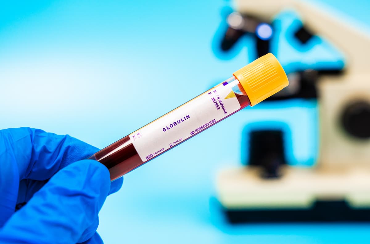 FDA Approves Immunoglobulin Formulation With Low IgA Content for Primary Immunodeficiency