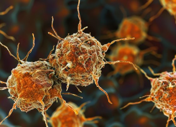 fda-approves-y-90-resin-microspheres-for-unrespectable-hepatocellular-carcinoma