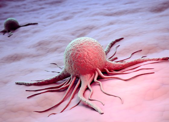 obesity-linked-exosomes-may-drive-tumor-aggressiveness-in-triple-negative-breast-cancer