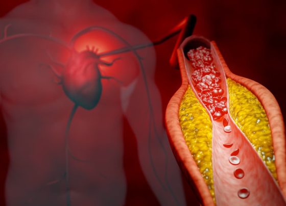 reassessing-the-safety-and-efficacy-of-very-low-ldl-cholesterol