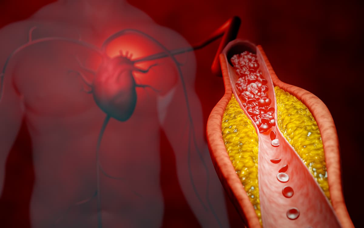 Reassessing the Safety and Efficacy of Very Low LDL Cholesterol