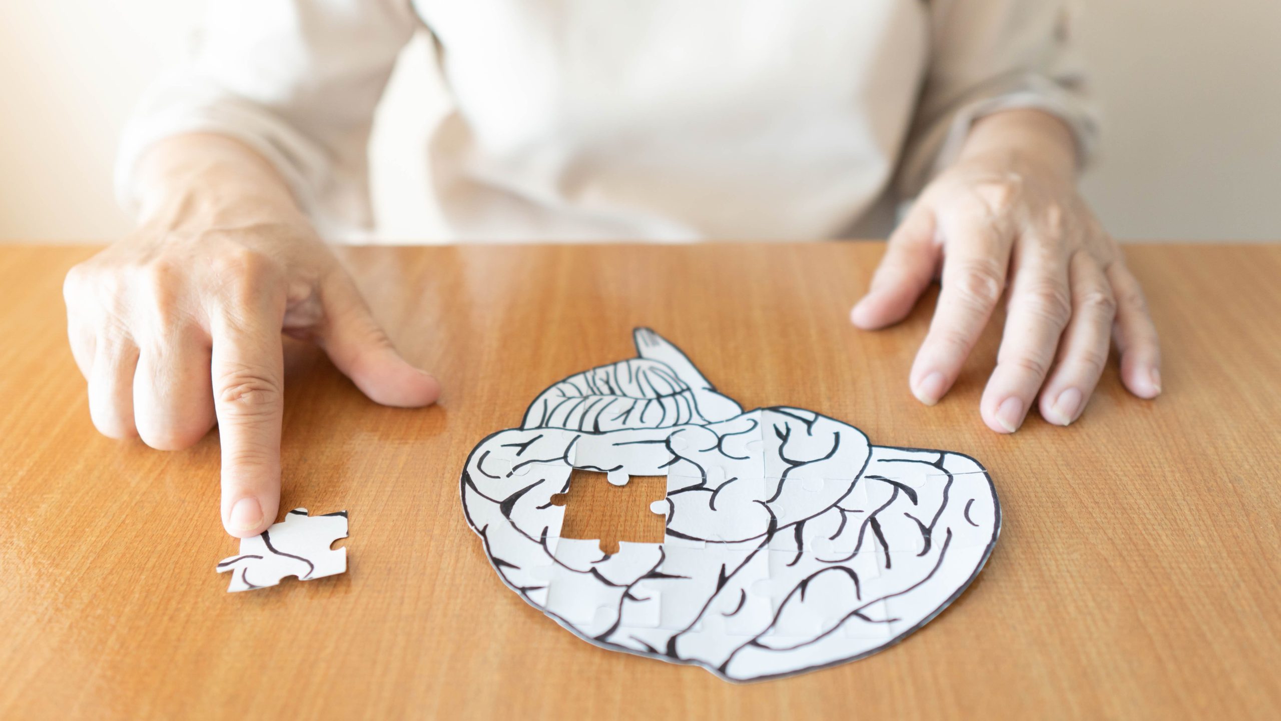 Donanemab-Azbt Receives FDA Label Update With New Dosing for Alzheimer Disease