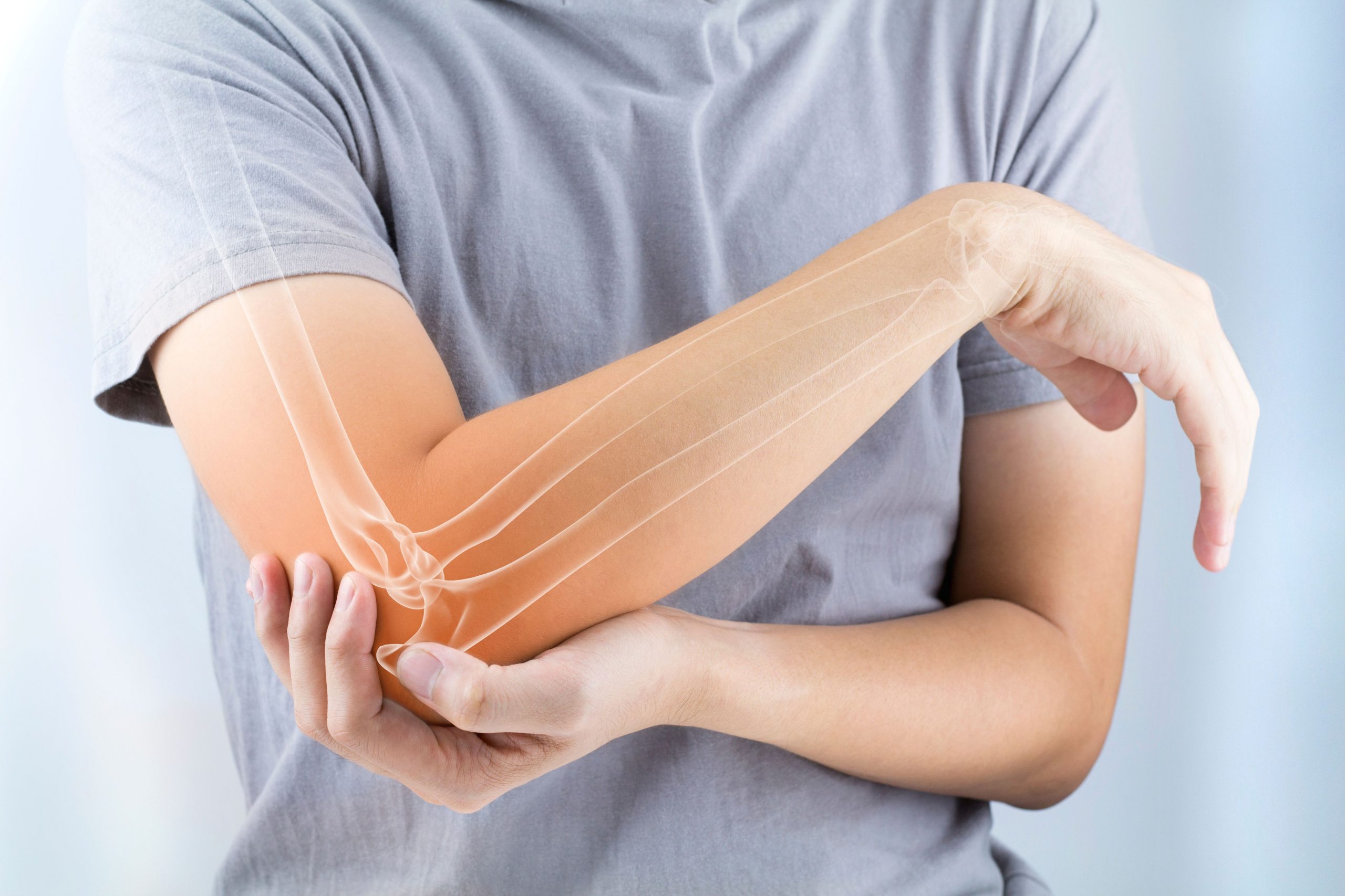 Type 2 Diabetes and Obesity in Teens Could Increase Risk of Osteoporosis