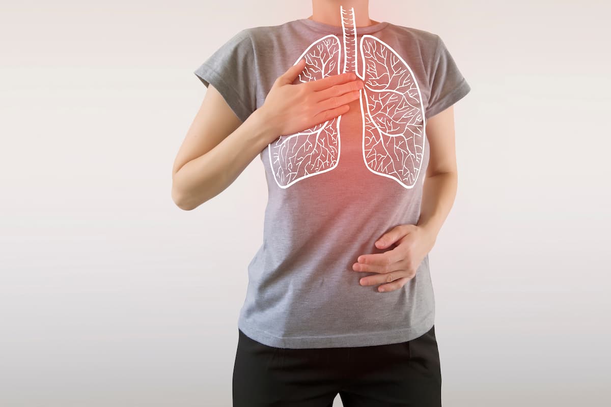 Does Corticosteroid Use Have a Role in Severe Community-Acquired Pneumonia?