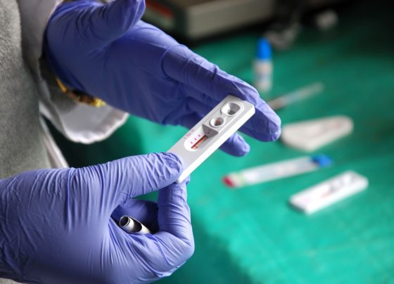 hiv-reporting-meets-the-front-line:-how-pharmacists-translate-global-health-into-local-care