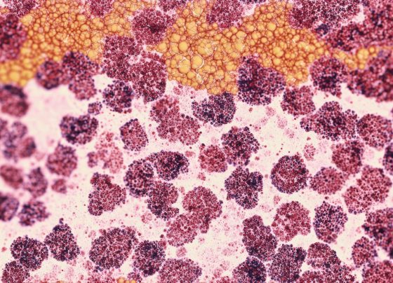 fda-issues-complete-response-letter-for-glofit-gemox-in-r/r-dlbcl