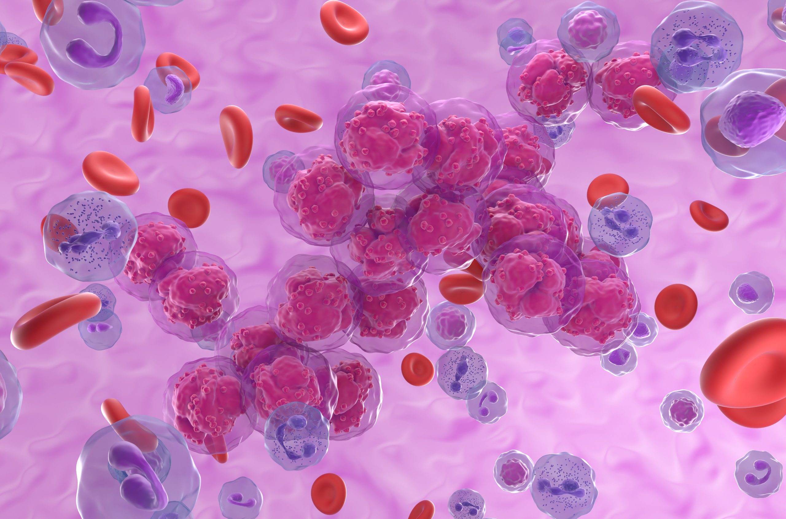 ImCheck’s ICT01 Earns FDA Orphan Drug Designation for AML