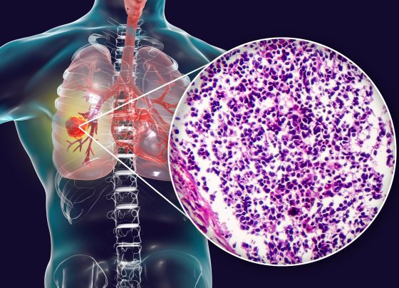 nuvalent-initiates-phase-3-alkazar-trial-of-neladalkib-in-nsclc