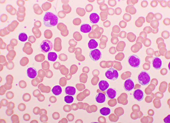 eha-2025:-no-added-toxicity-observed-with-bleximenib-plus-venetoclax-and-azacitidine-in-aml