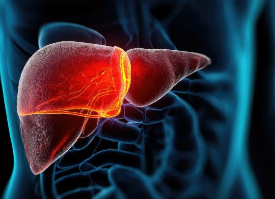 remnant-cholesterol,-independent-of-ldl-c,-serves-as-predictor-of-masld
