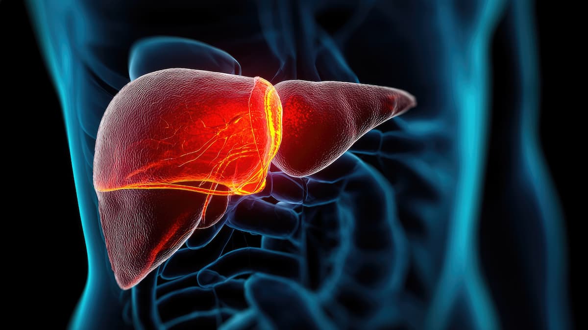 Remnant Cholesterol, Independent of LDL-C, Serves as Predictor of MASLD