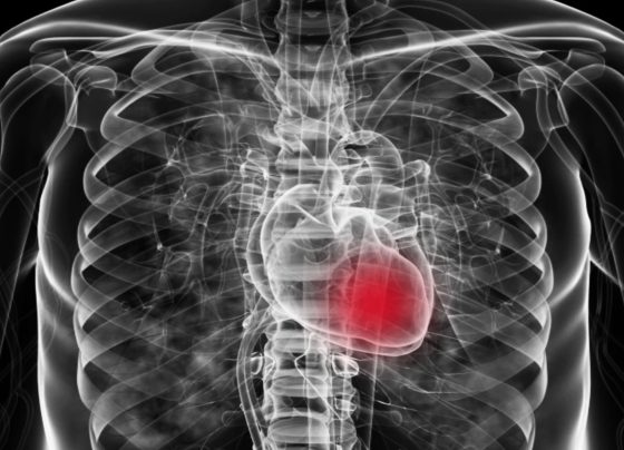 pharmacists-weigh-promise-and-challenges-of-finerenone-for-patients-with-hfpef