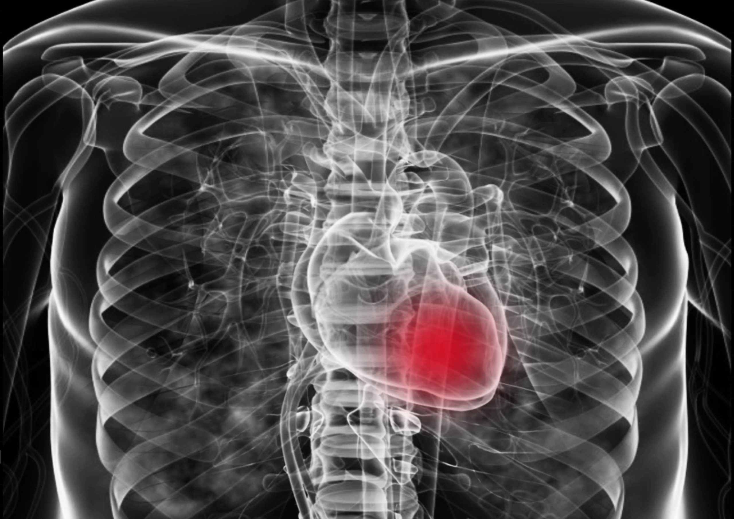 Pharmacists Weigh Promise and Challenges of Finerenone for Patients With HFpEF