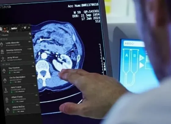 aidoc-raises-$150m-for-ai-foundation-model