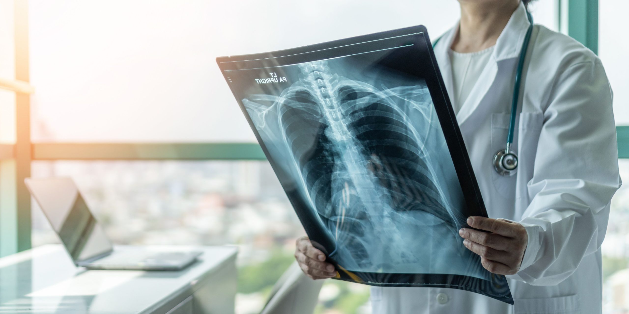 Integrated Care Pathways and Future Directions in COPD Management at UPMC