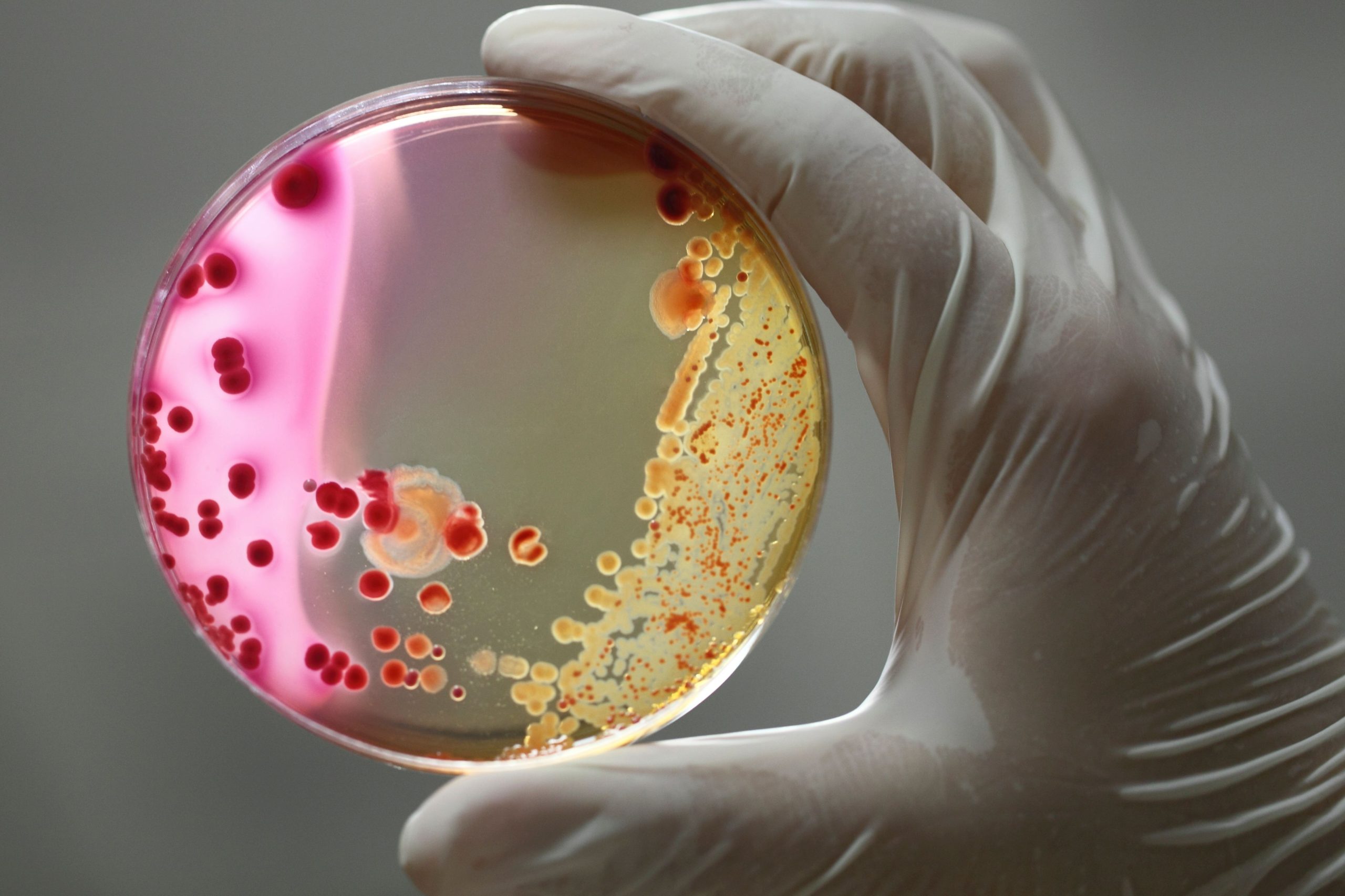 A Review of Oral Cephalosporins for Common Outpatient Infections