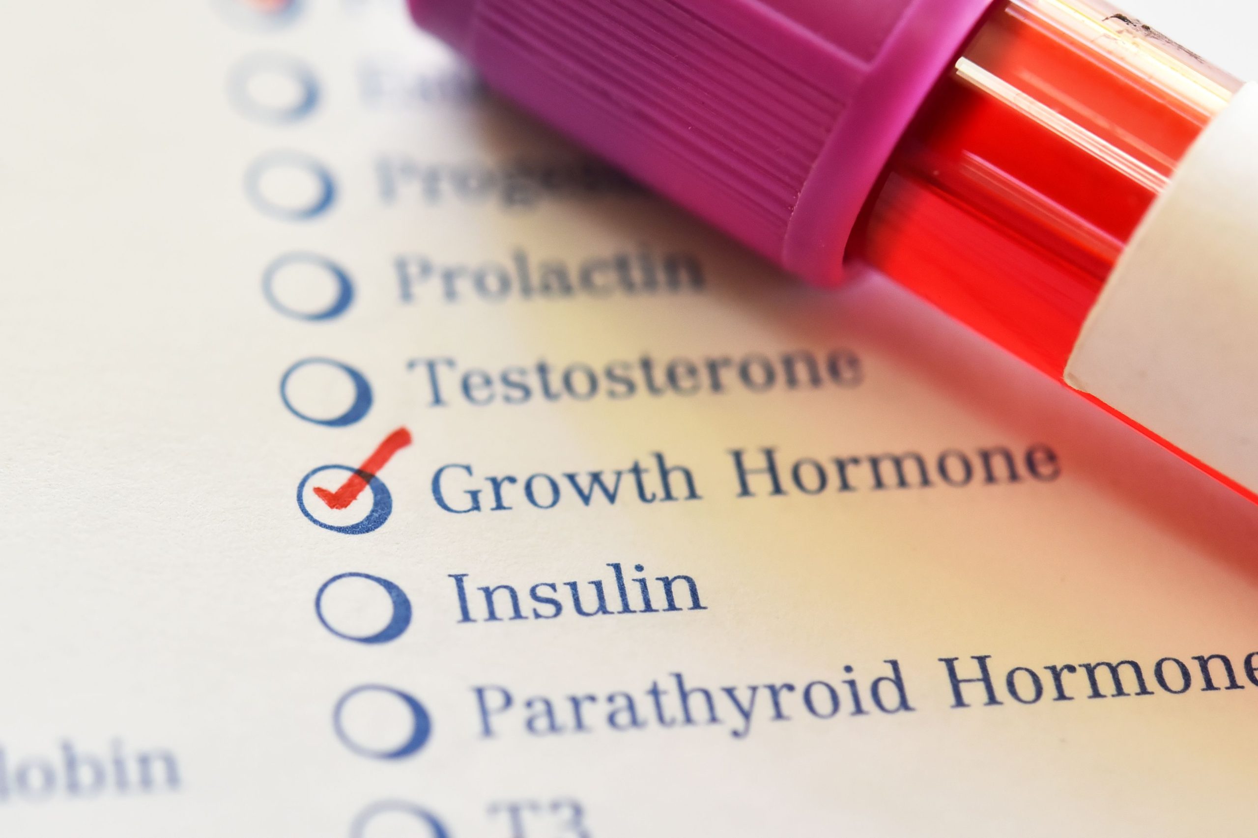 Lonapegsomatropin-Tcgd Receives FDA Approval for Growth Hormone Deficiency