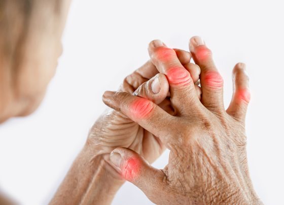 omega-3-fatty-acids-and-vitamin-d-improves-inflammatory-biomarkers-in-rheumatoid-arthritis