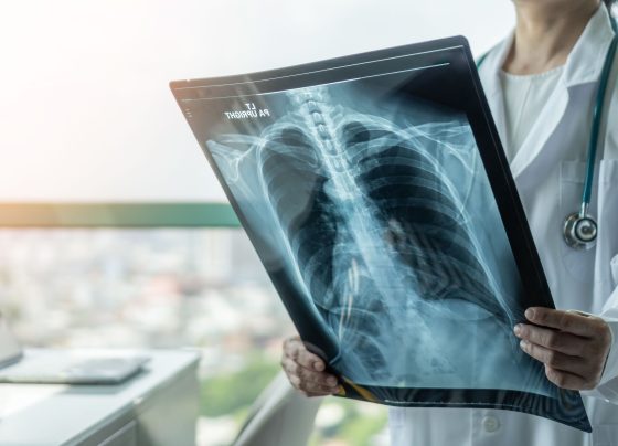 astegolimab-reduces-copd-exacerbations-in-clinical-trials