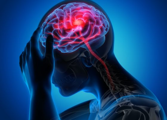 weight-loss-drugs-show-promise-in-preventing-stroke-and-reducing-brain-injury-complications
