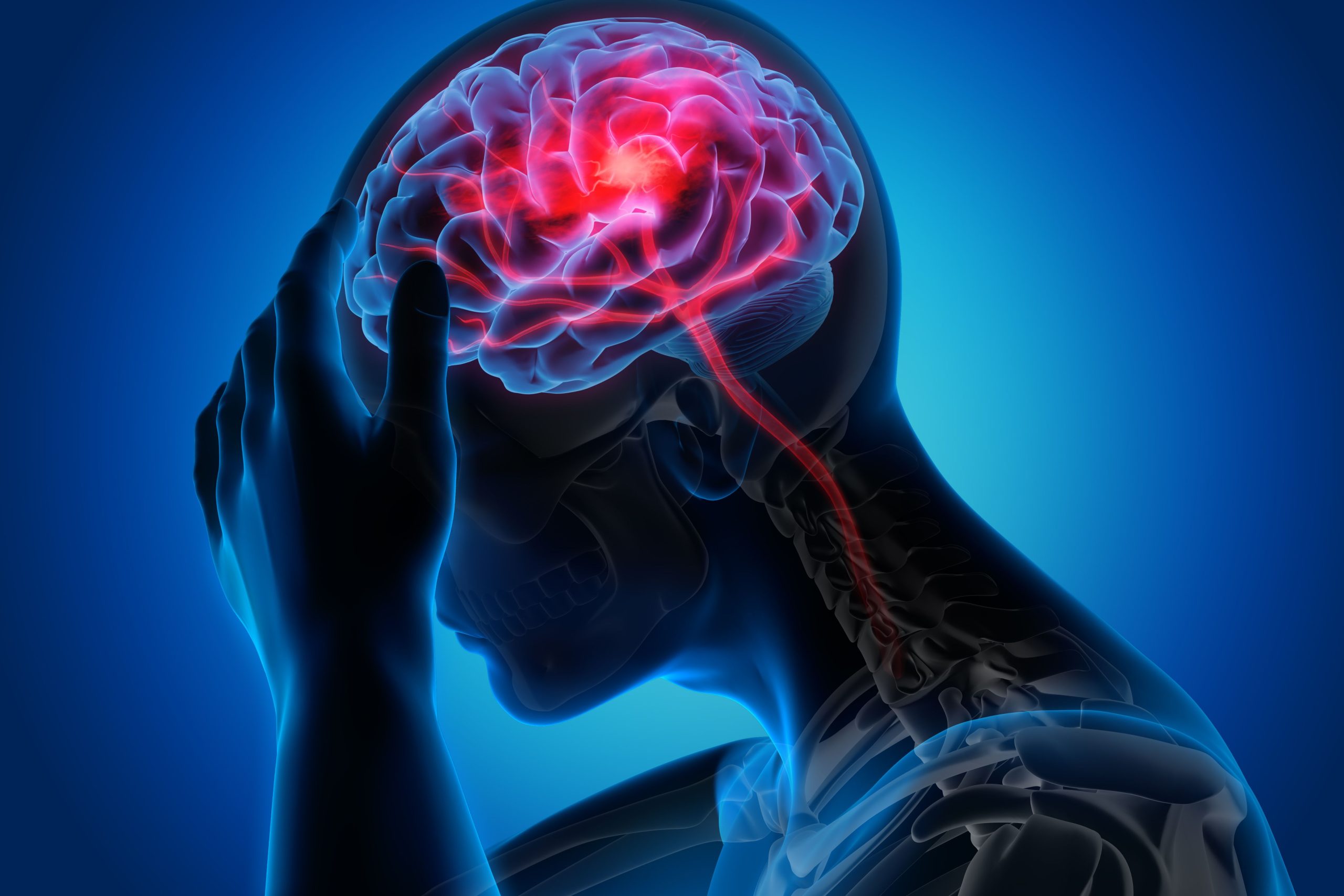 Weight Loss Drugs Show Promise in Preventing Stroke and Reducing Brain Injury Complications