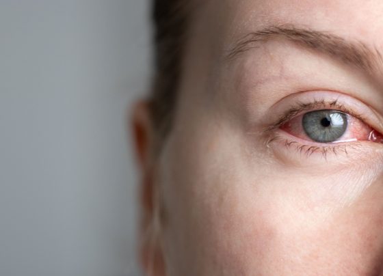 biosimilar-mvasi-demonstrates-similar-ophthalmic-safety-profile-to-reference-product-avastin