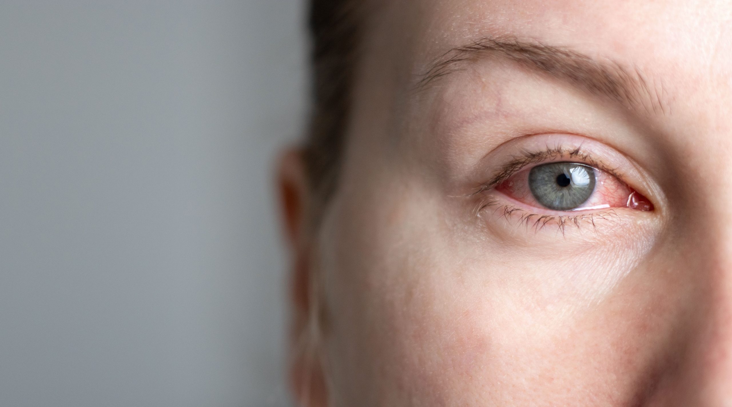 Biosimilar Mvasi Demonstrates Similar Ophthalmic Safety Profile to Reference Product Avastin