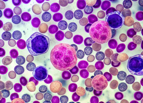 video:-pharmacists-take-center-stage-in-delivering-linvoseltamab,-advancing-myeloma-care