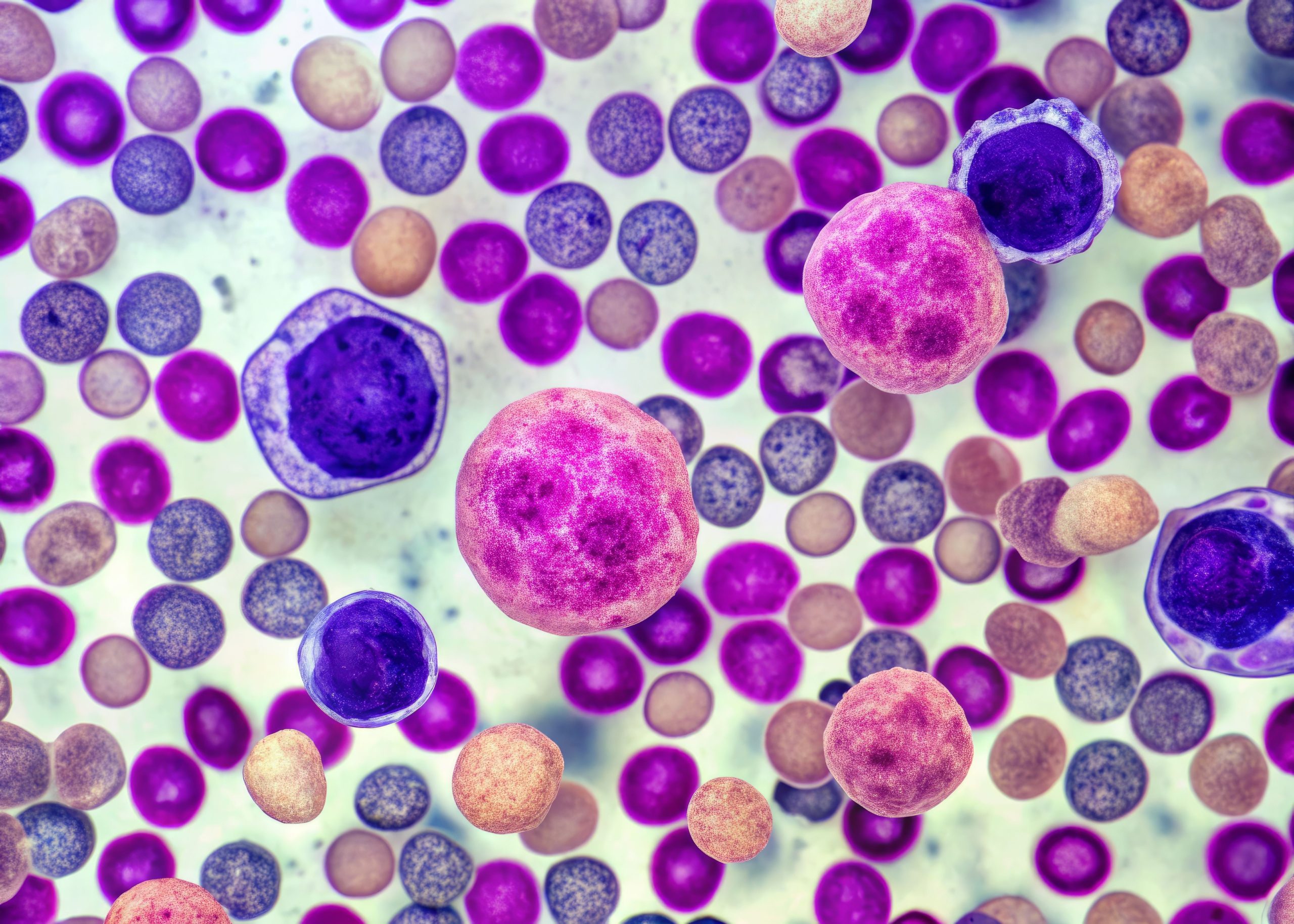 Video: Pharmacists Take Center Stage in Delivering Linvoseltamab, Advancing Myeloma Care
