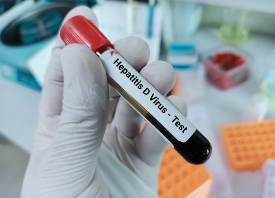 hepatitis-d-reclassified-as-carcinogenic,-according-to-who