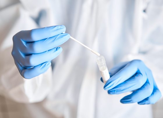 non-invasive-saliva-tests-could-offer-early-clues-for-diabetes-and-obesity-risk