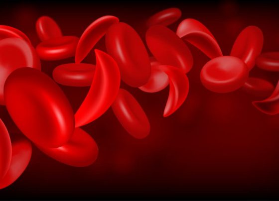 changing-the-course-of-scd:-one-dose-of-hydroxyurea-at-a-time