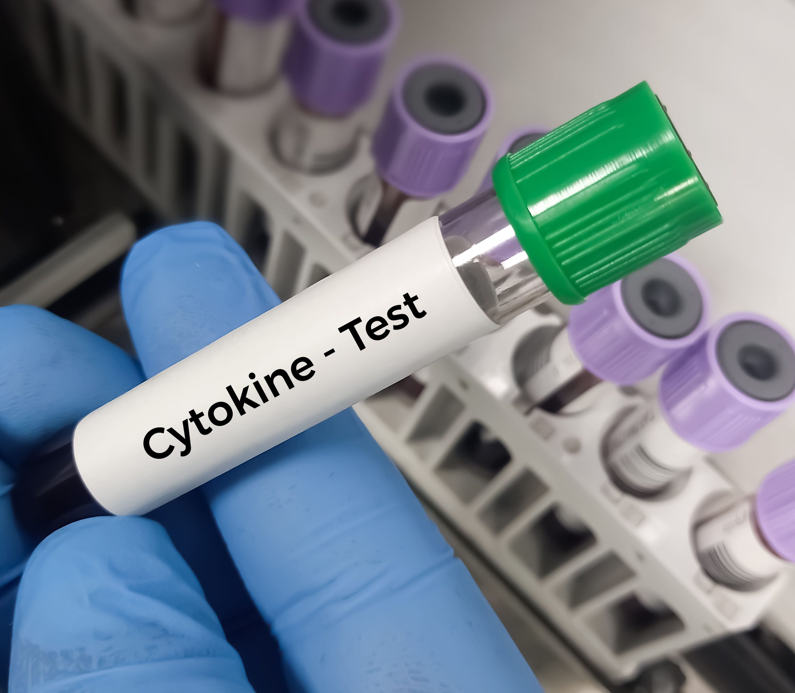 FDA Approves Expanded Indication to Tocilizumab-Anoh IV for CRS