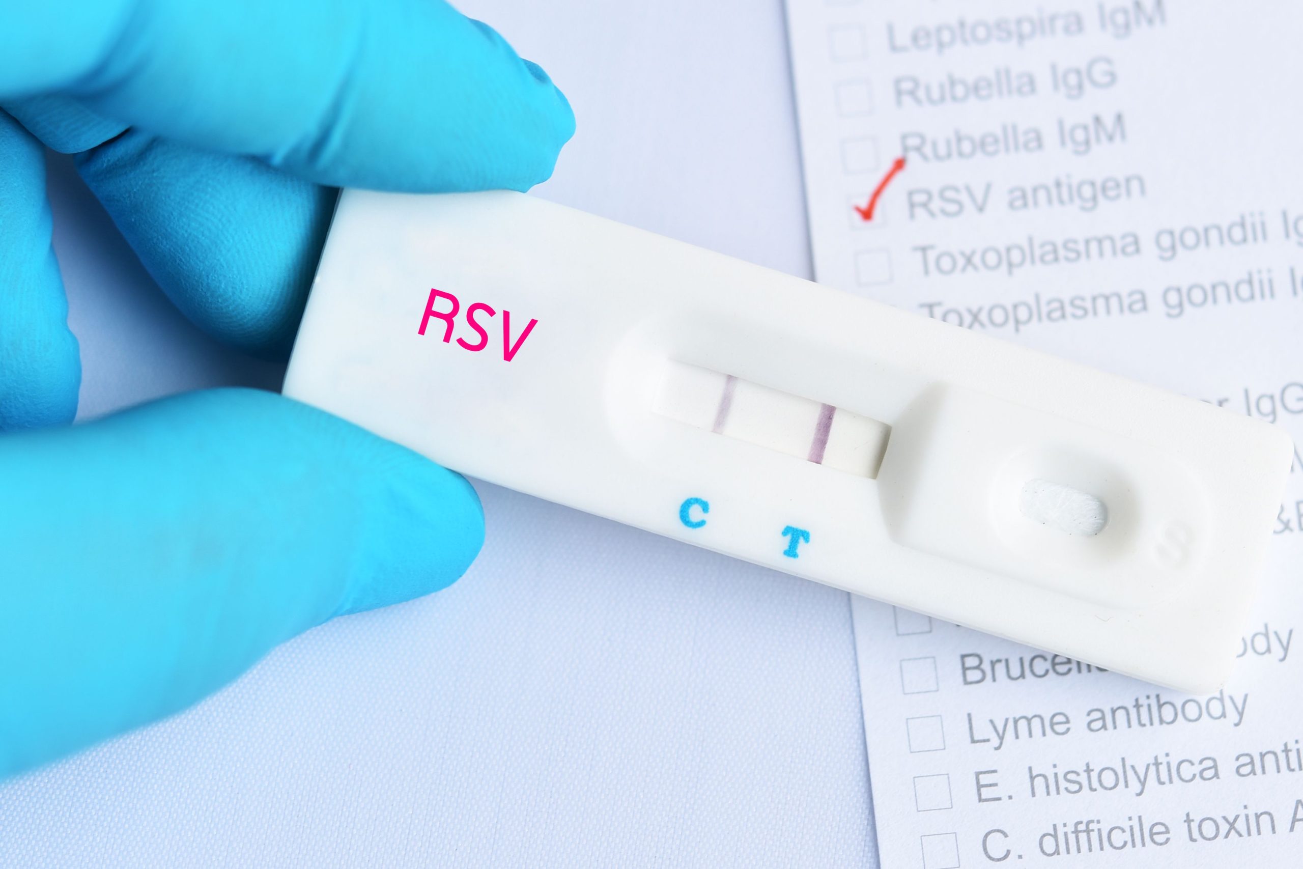 Researchers Evaluate Infection Control Challenges During an RSV Outbreak in a Cognitively Impaired Population