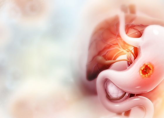 targeting-tumors:-new-weapons-in-gastrointestinal-cancer-therapy