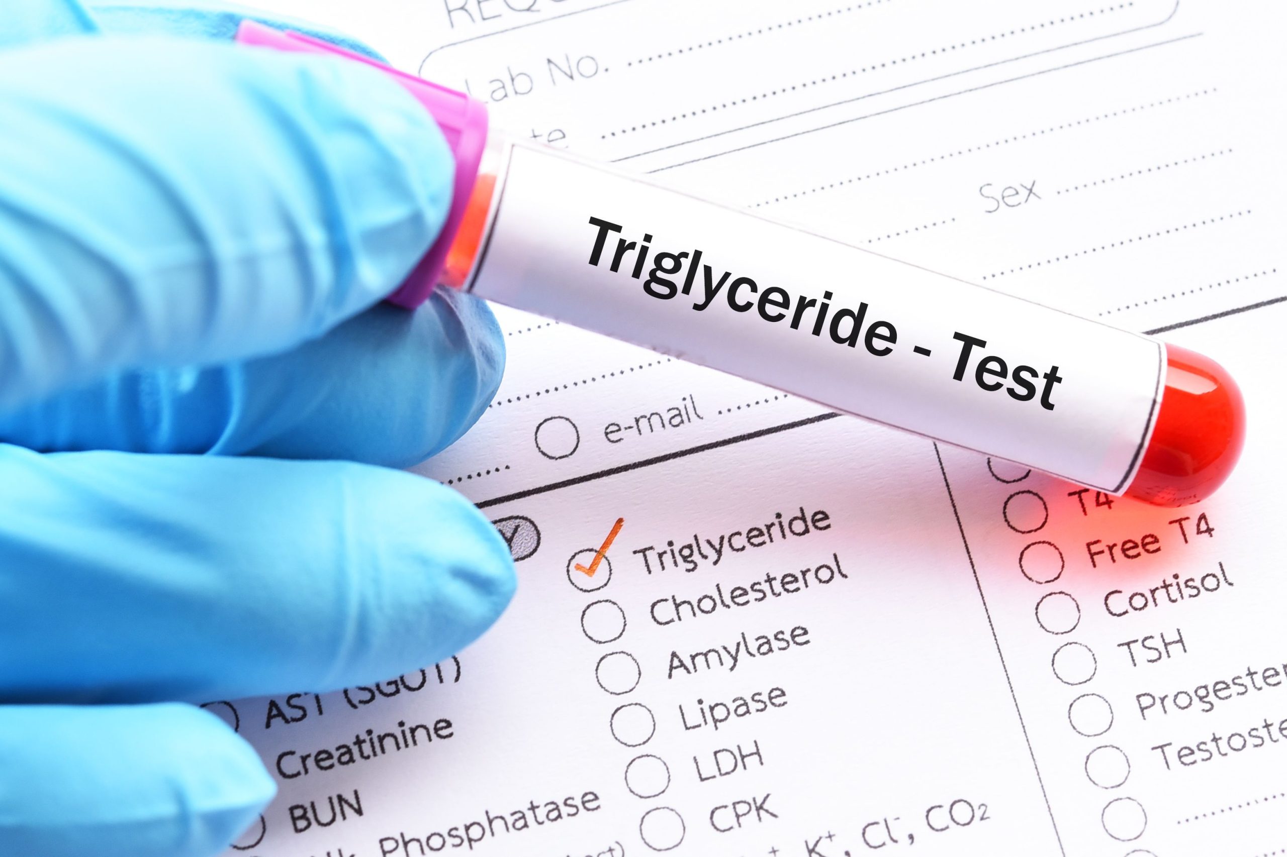 FDA Reviews Plozasiran: A Potential First-in-Class Therapy for Familial Chylomicronemia Syndrome