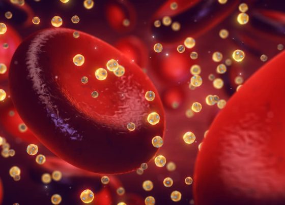 elevated-high-density-lipoprotein-cholesterol-may-reduce-risk-of-stress-urinary-incontinence