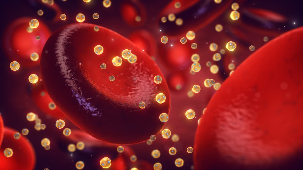 Elevated High-Density Lipoprotein Cholesterol May Reduce Risk of Stress Urinary Incontinence