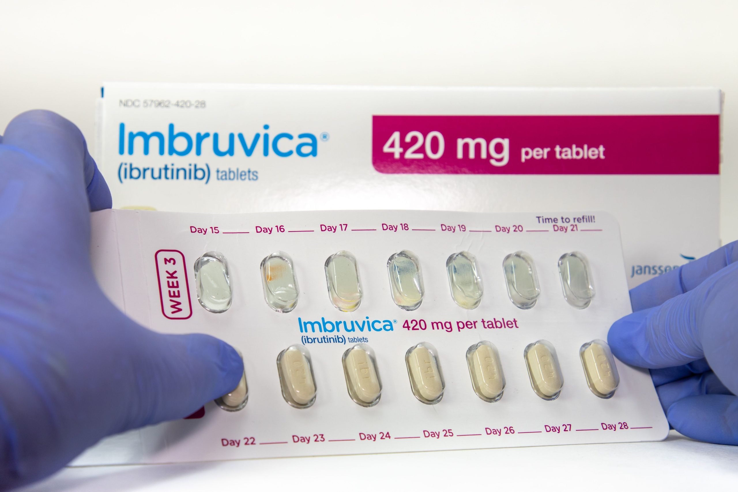 Ibrutinib–Venetoclax Outperforms Ibrutinib Alone and FCR in Long-Term CLL